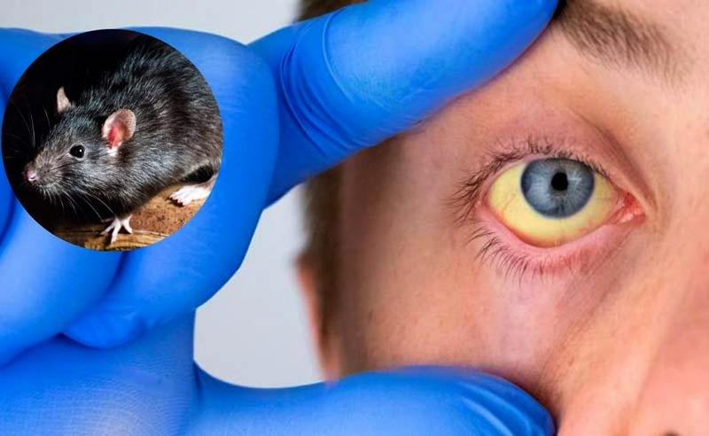 Alerta por Santa Fe que es la provincia con más casos de leptospirosis en la región centro Alerta por Santa Fe que es la provincia con más casos de leptospirosis en la región centro