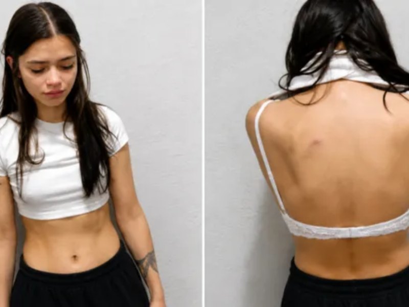 Qué dijo el médico que examinó a la joven acusada de matar a su novio en Chaco Qué dijo el médico que examinó a la joven acusada de matar a su novio en Chaco