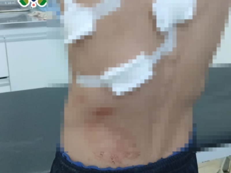 Hirió a su hermano con un cuchillo y fue detenido Hirió a su hermano con un cuchillo y fue detenido